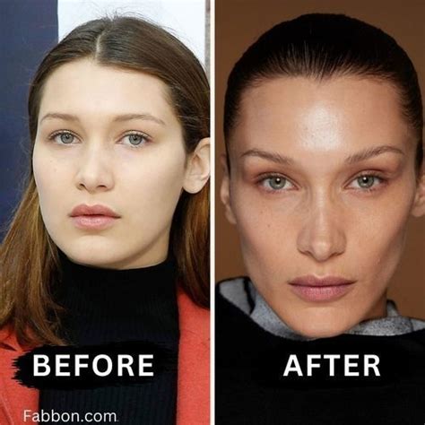 bella hadid buccal fat removal|17 Celebrities Who Have Had Buccal Fat Removal